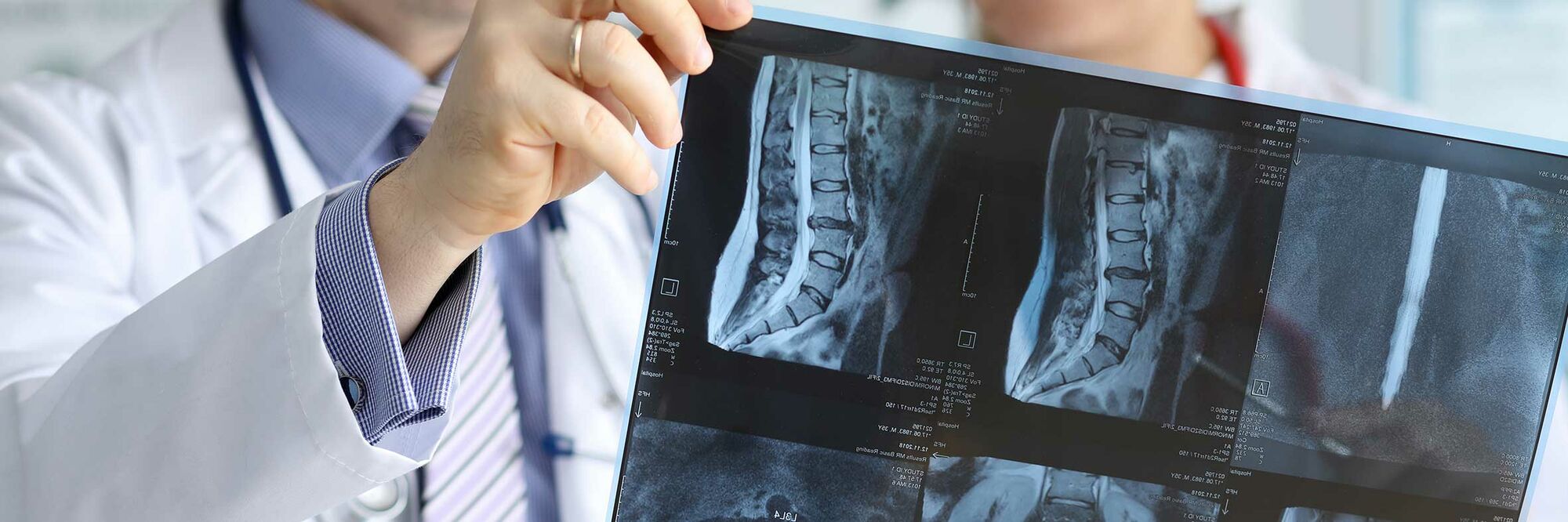 Das Foto zeigt zwei Ärztinnen, die sich radiologische Aufnahmen einer menschlichen Wirbelsäule anschauen.
